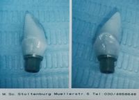 Experte Zahnimplantate Berlin Dr. Stoltenburg M.Sc.,M.Sc.,MPI /Tätigkeitsschwerpunkt Implantologie Implantatprothetik / Implantatkronen / Implantatbrücken